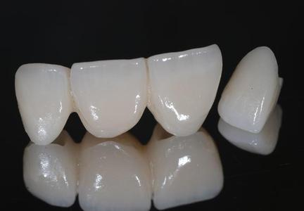 Brücken und Sonderkonstruktionskurs Stufe 3 in Berlin