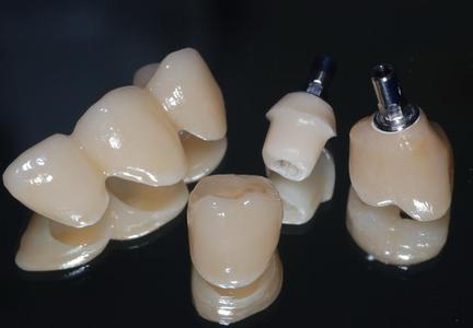 Brücken und Sonderkonstruktionskurs Stufe 3 in Berlin