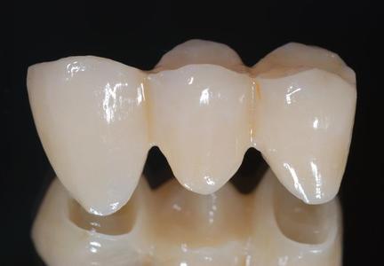 Ivoclar Vivadent Kurse in Zwickau